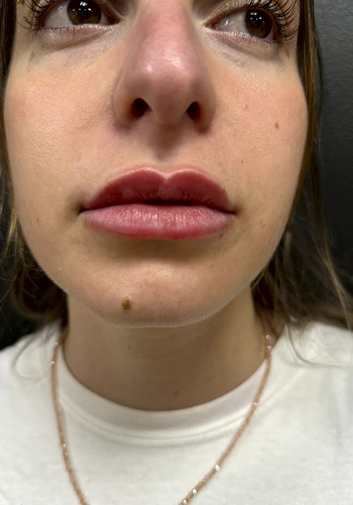 social-proof-vitalle-05